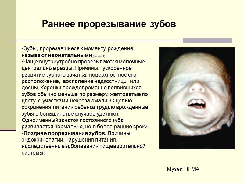 Зубы, прорезавшиеся к моменту рождения, называют неонатальными.(см. музей) Чаще внутриутробно прорезываются молочные центральные резцы.